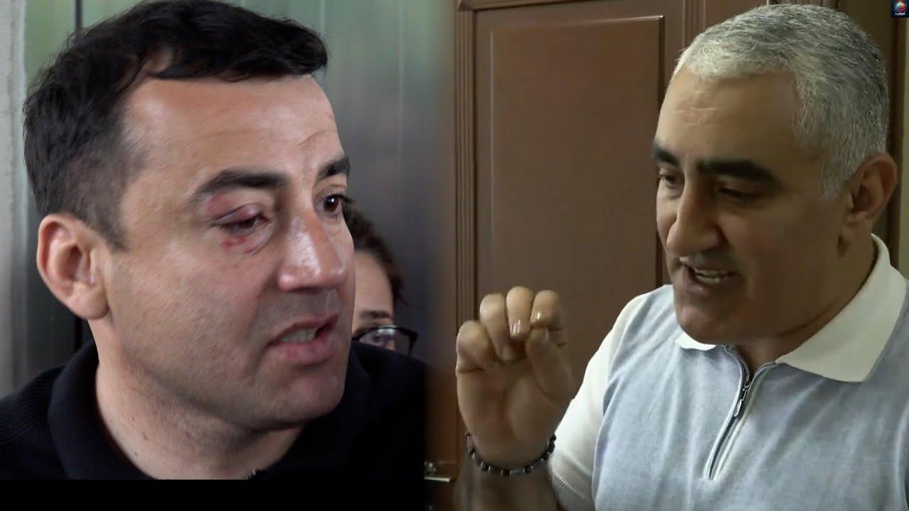 Ով առաջինը հարվածեց. մանրամասներ՝ Նոր Նորքի թաղապետարանի ծեծկռտուքից
