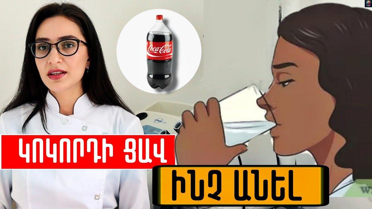Ի՞նչ տեղի կունենա, եթե կոկորդի ցավի ժամանակ կոկա կոլայով ողողումներ կատարեք. լսեք բժշկին