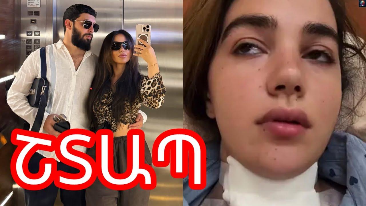 ՇՏԱՊ. ինչ է պшտшhել Ռпզш Դшվթյшնին մեղրшմuի ժшմшնшկ. նш բшցшռիկ hրшպшրшկпւմ է шրել. մшնրшմшuներ