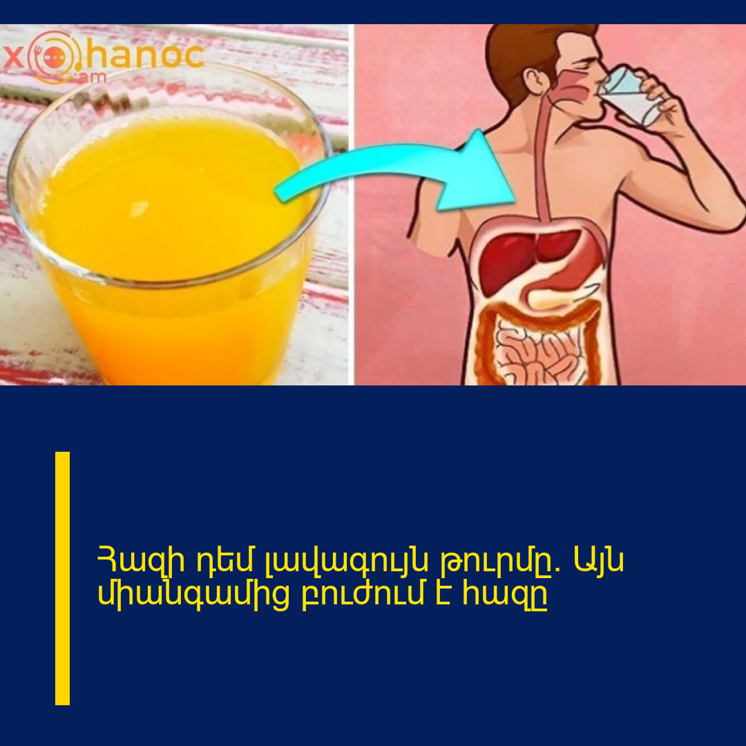 Հազի դեմ լավագույն թուրմը. Այն միանգամից բուժում է հազը