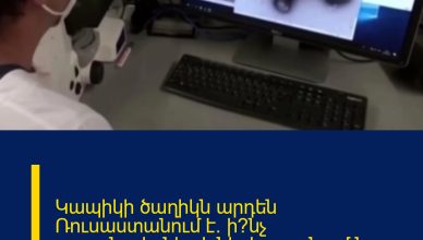 Կապիկի ծաղիկն արդեն Ռուսաստանում է. ի՞նչ սպառնալիքներ է ներկայացնում նոր վիրուսը