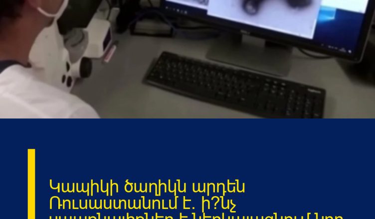 Կապիկի ծաղիկն արդեն Ռուսաստանում է. ի՞նչ սպառնալիքներ է ներկայացնում նոր վիրուսը