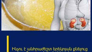 Ինչու է անհրաժեշտ երեկոյան քնելուց առաջ մեղր ուտել․ տեղեկացեք