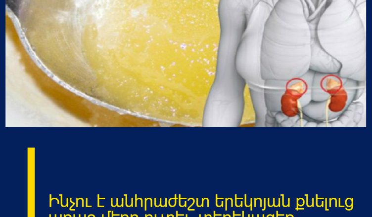 Ինչու է անհրաժեշտ երեկոյան քնելուց առաջ մեղր ուտել․ տեղեկացեք