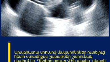 Արաբիատա սոուսով մակարոնիներ ուտելուց հետո ստամոքսս շաբաթներ շարունակ ցավում էր: Դեղերը օգուտ չէին տալիս, գնացի հիվանդանոց, ու ՈՒԶԻ-ի ժամանակ բժիշկի ախտորոշումը ինձ ցնցեց: