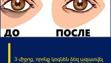 3 միջոց, որոնք կօգնեն ձեզ ազատվել աչքերի տակ մուգ շրջանակներից։