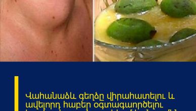 Վահանաձև գեղձը վիրահատելու և ավելորդ հաբեր օգտագաործելու կարիք չկա. այն բուժվում է ընդամենը այս մեկ բաղադրիչով