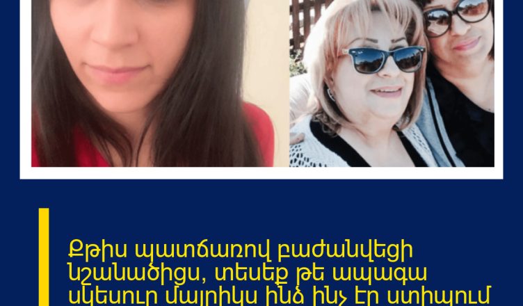 Քթիս պատճառով բաժանվեցի նշանածիցս, տեսեք թե ապագա սկեսուր մայրիկս ինձ ինչ էր ստիպում անել. ես էլ ոչ մի վարկյան չեմ փոշմանում իմ արածից.