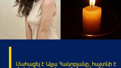 Մահացել է Ալլա Հակոբյանը, հայտնի է մահվան պատճառը մանրամասներ