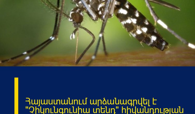 Հայաստանում արձանագրվել է «Չիկունգունիա տենդ» հիվանդության դեպք