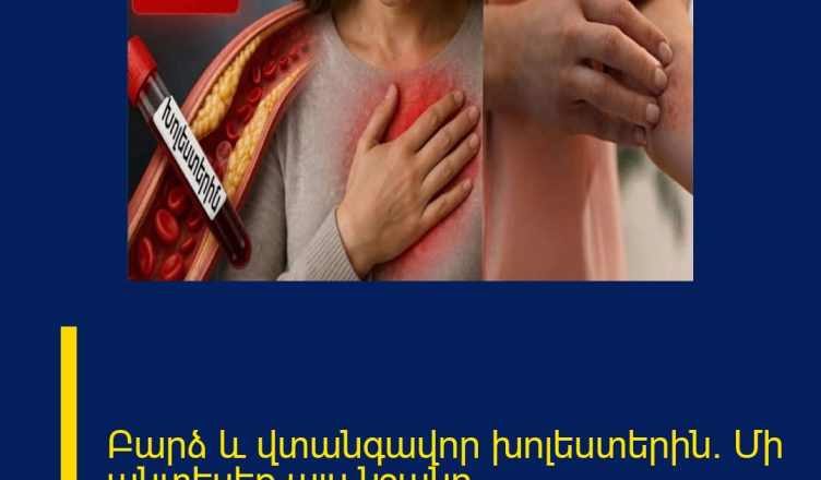 Բարձ և վտանգավոր խոլեստերին․ Մի անտեսեք այս նշանը