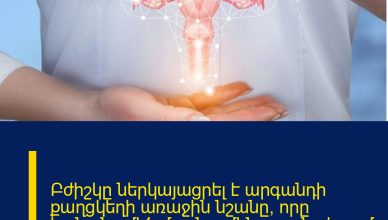 Բժիշկը ներկայացրել է արգանդի քաղցկեղի առաջին նշանը, որը  կանանց մեծ մասն ամեն օր անտեսում է